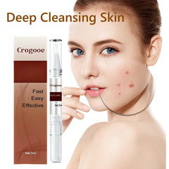 Warts and Moles Removal Deep Cleansing Skin, Beauty Tools Facial & Body Comfort Skincare