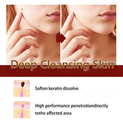 Warts and Moles Removal Deep Cleansing Skin, Beauty Tools Facial & Body Comfort Skincare