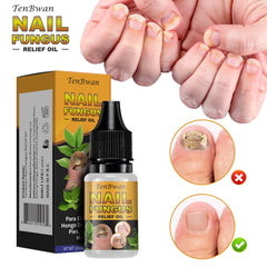 Tea Tree Oil + Oregano Oil,Nail Care Liquid Nail Strengthener,Instant Nail Care-Nail Care,Instant Soothing Nail Polish